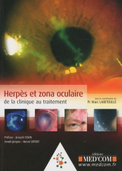 Dernières parutions dans , Herpès et zona oculaire de la clinique au traitement 