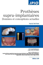 Dernières parutions dans , Prothèses supra-implantaires 