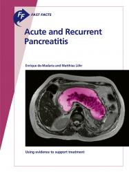 Acute and Recurrent Pancreatitis