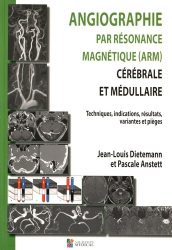 Angiographie par résonance magnétique (ARM) cérébrale et médullaire