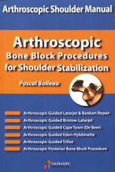 Arthroscopic bone block procedures for shoulder stabilization