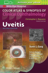 Atlas & Synopsis Clinical Ophthalmology: uveitis