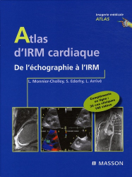Atlas d'IRM cardiaque