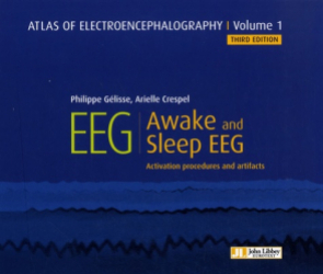 Atlas of electroencephalography - Tome 1, Awake and sleep eeg
