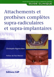 Attachement et prothèses complètes supra-radiculaires et supra-implantaires