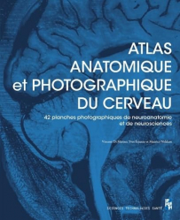 Vous recherchez les livres à venir en PASS - LAS, Atlas anatomique et photographique du cerveau