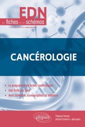 Cancérologie - EDN en fiches et en schémas