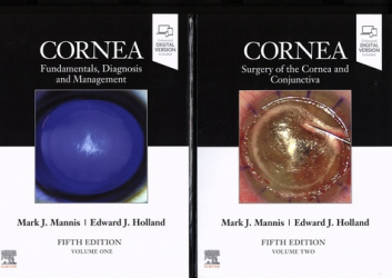 Cornea : 2-Volume Set
