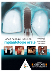 Codes de la Réussite en Implantologie Orale