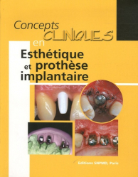Concepts cliniques en Esthétique et prothèse implantaire