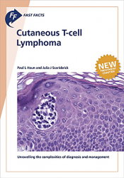 Vous recherchez des promotions en Sciences médicales, Cutaneous T-cell Lymphoma