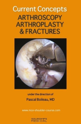 Current Concepts : Arthroscopy, Arthroplasty & Fractures