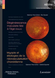 Dégénérescence maculaire liée à l'âge (DMLA) / Myopie et étiologies de la néovascularisation choroïdienne