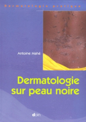 Dermatologie sur peau noire