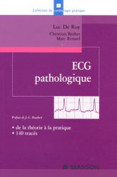 ECG pathologique