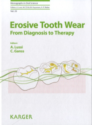 Vous recherchez des promotions en Dentaire, Erosive Tooth Wear