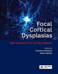 Focal cortical dysplasias