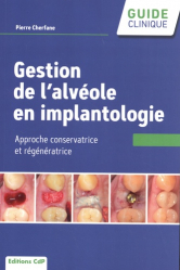 Meilleures ventes chez Meilleures ventes de la collection Guide Clinique - cdp, Gestion de l'alvéole en implantologie