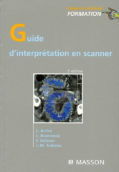 Guide d'interprétation en scanner. 3e édition