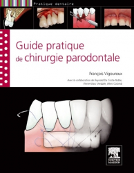 Guide pratique de la chirurgie parodontale