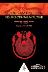 Guide pratique de neuro-ophtalmologie