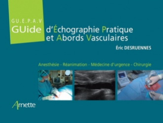 Guide d'échographie pratique des abords vasculaires (GU.E.P.A.V)