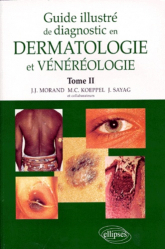 Guide illustré de diagnostic en dermatologie et vénéréologie Tome 2