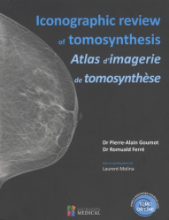 Iconographic review of tomosynthesis