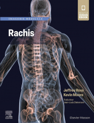 Vous recherchez les livres à venir en Imagerie médicale, Imagerie médicale : Rachis