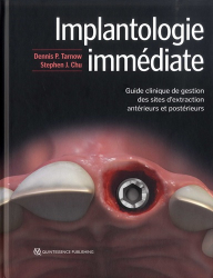Meilleures ventes de la Editions quintessence international : Meilleures ventes de l'éditeur, Implantologie Immédiate