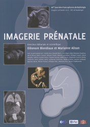 Imagerie prénatale