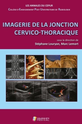 Imagerie de la jonction cervico-thoracique