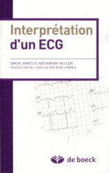 Interprétation d'un ECG