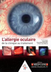 L'allergie oculaire : de la clinique au traitement