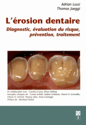 L'érosion dentaire