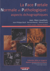 La face foetale normale et pathologique : aspects échographiques