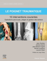 Le poignet traumatique - 10 interventions courantes