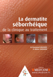 Le dermatite séborrhéique de la clinique au traitement