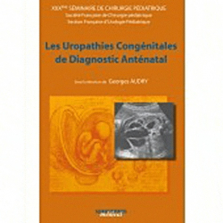 Les uropathies congénitales de diagnostic anténatal