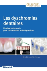 Les dyschromies dentaires