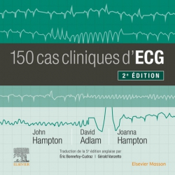 150 cas cliniques d'ECG de HAMPTON