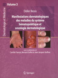 Manifestations dermatologiques des maladies du système hématopoïétique et oncologie dermatologique Volume 3