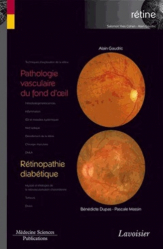 Pathologie vasculaire du fond d'oeil / Rétinopathie diabétique