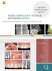 Peri-implant Tissue Remodeling
