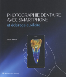 Photographie Dentaire avec Smartphone et éclairage auxilliaire