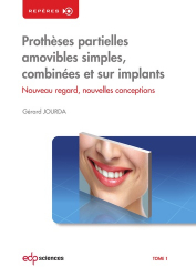 Prothèses partielles amovibles simples, combinées et sur implants Tome 1