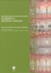 Propositions orthodontiques / Classe II / Situations critiques