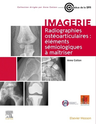 Vous recherchez les meilleures ventes rn Imagerie médicale, Radiographies ostéoarticulaires