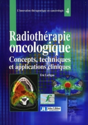 Radiothérapie oncologique
