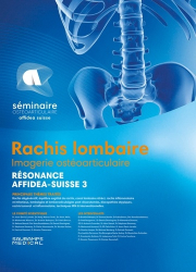 Vous recherchez les meilleures ventes rn Imagerie médicale, Rachis lombaire - Imagerie ostéoarticulaire